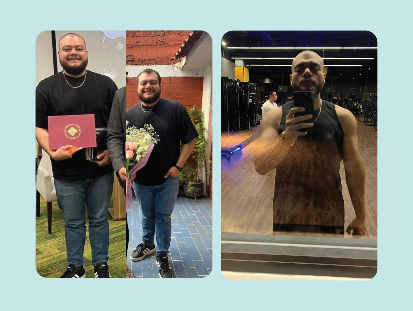 Antes y después — tratamiento sin cirugía